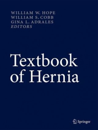 Knjiga Textbook of Hernia William W. Hope