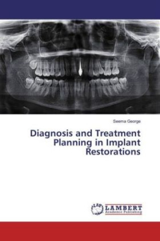 Kniha Diagnosis and Treatment Planning in Implant Restorations Seema George