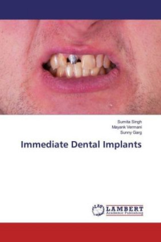 Knjiga Immediate Dental Implants Sumita Singh