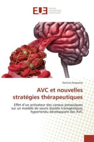 Carte AVC et nouvelles stratégies thérapeutiques Dorinne Desposito