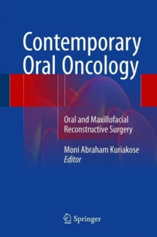 Kniha Contemporary Oral Oncology Moni Abraham Kuriakose
