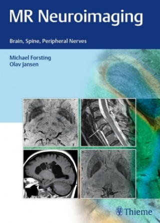 Kniha MR Neuroimaging Olav Jansen