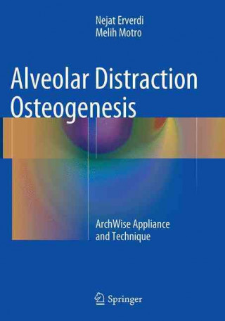 Kniha Alveolar Distraction Osteogenesis Nejat Erverdi