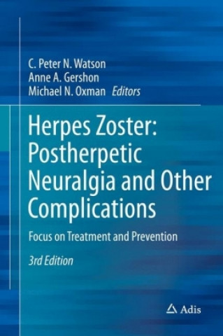 Kniha Herpes Zoster: Postherpetic Neuralgia and Other Complications C. Peter N. Watson