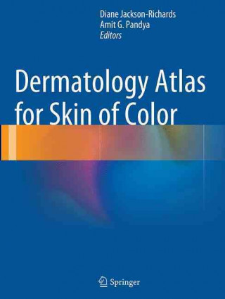 Carte Dermatology Atlas for Skin of Color Diane Jackson-Richards