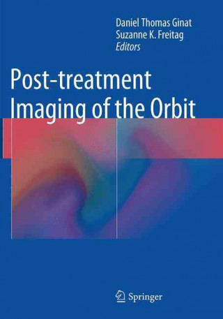 Carte Post-treatment Imaging of the Orbit Daniel Ginat