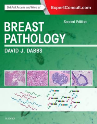 Knjiga Breast Pathology David J. Dabbs