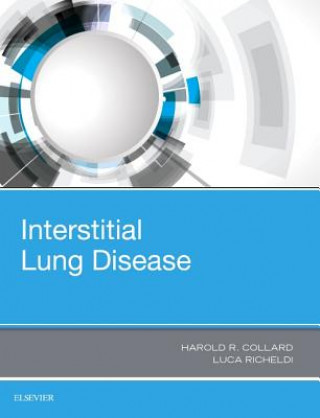 Kniha Interstitial Lung Disease Luca Richeldi