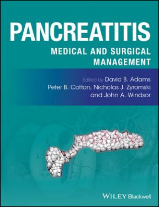 Książka Pancreatitis - Medical and Surgical Management David B. Adams