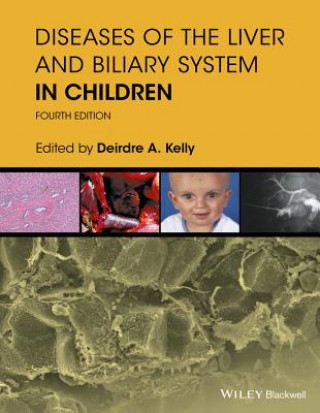 Knjiga Diseases of the Liver & Biliary System in Children  4e Deirdre Kelly