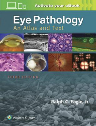 Carte Eye Pathology Ralph C. Eagle