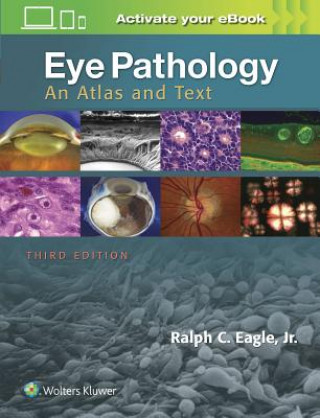 Kniha Eye Pathology Ralph C. Eagle