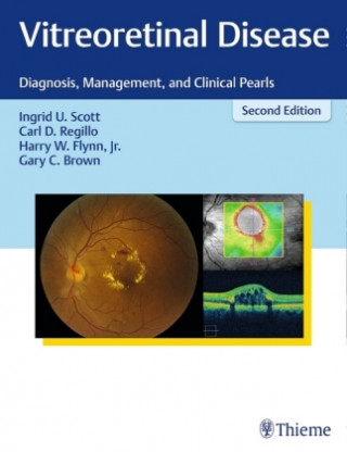 Könyv Vitreoretinal Disease Ingrid Scott