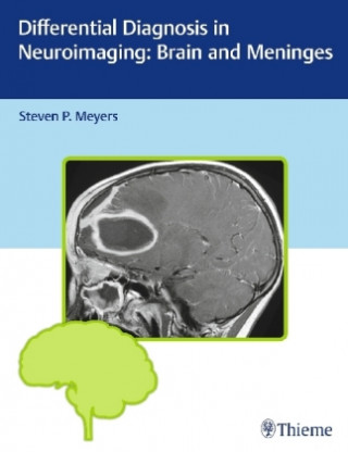 Könyv Differential Diagnosis in Neuroimaging: Brain and Meninges Steven P. Meyers