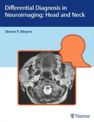 Könyv Differential Diagnosis in Neuroimaging: Head and Neck P. Steven Meyers