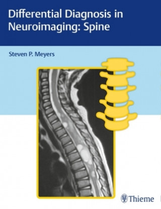 Книга Differential Diagnosis in Neuroimaging: Spine P. Steven Meyers