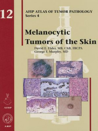 Kniha Melanocytic Tumors of the Skin David E. Elder