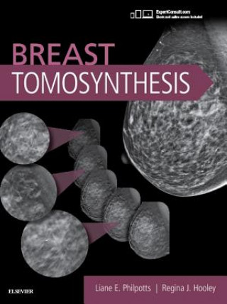 Kniha Breast Tomosynthesis Liane E Philpotts