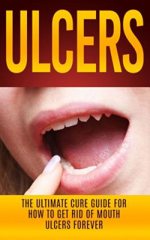 Książka Ulcers Wade Migan