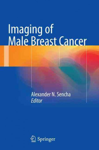 Könyv Imaging of Male Breast Cancer Alexander N. Sencha