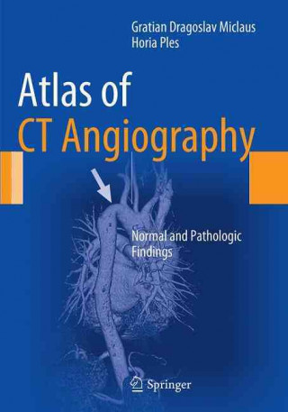 Könyv Atlas of CT Angiography Gratian Dragoslav Miclaus