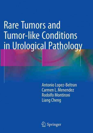 Libro Rare Tumors and Tumor-like Conditions in Urological Pathology Antonio Lopez-Beltran