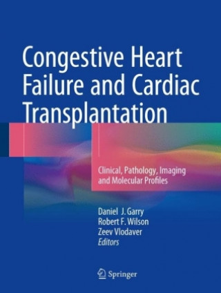 Kniha Congestive Heart Failure and Cardiac Transplantation Daniel J. Garry