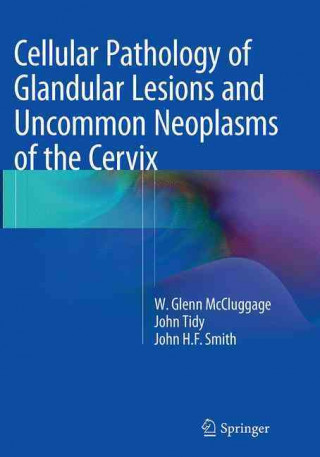 Kniha Cellular Pathology of Glandular Lesions and Uncommon Neoplasms of the Cervix W. Glenn McCluggage