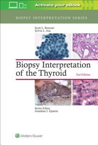 Könyv Biopsy Interpretation of the Thyroid Scott L. Boerner