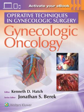 Carte Operative Techniques in Gynecologic Surgery Kenneth Hatch