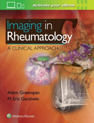 Könyv Imaging in Rheumatology Adam Greenspan