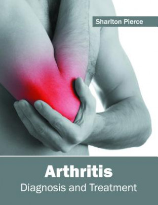 Carte Arthritis: Diagnosis and Treatment Sharlton Pierce