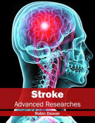 Książka Stroke: Advanced Researches Robin Deaver