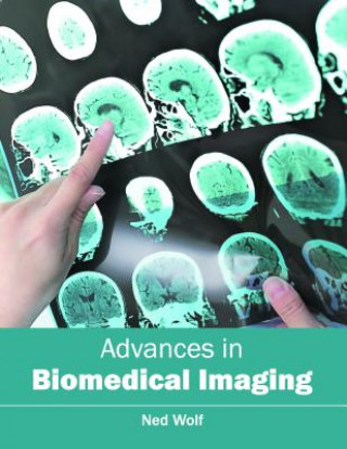 Knjiga Advances in Biomedical Imaging Ned Wolf