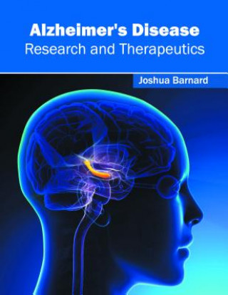 Książka Alzheimer's Disease: Research and Therapeutics Joshua Barnard