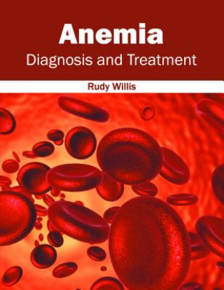 Kniha Anemia: Diagnosis and Treatment Rudy Willis