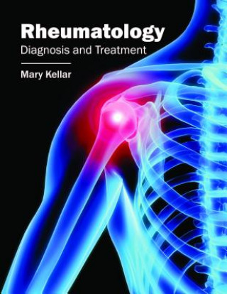Книга Rheumatology: Diagnosis and Treatment Mary Kellar