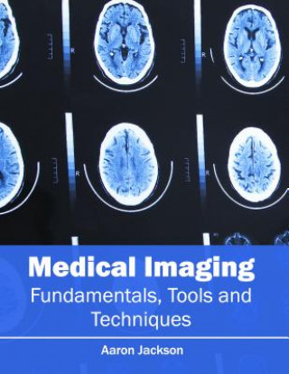 Kniha Medical Imaging: Fundamentals, Tools and Techniques Aaron Jackson