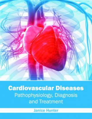 Книга Cardiovascular Diseases: Pathophysiology, Diagnosis and Treatment Janice Hunter