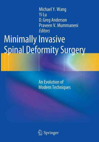 Carte Minimally Invasive Spinal Deformity Surgery Michael Wang