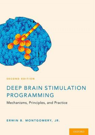Kniha Deep Brain Stimulation Programming Montgomery