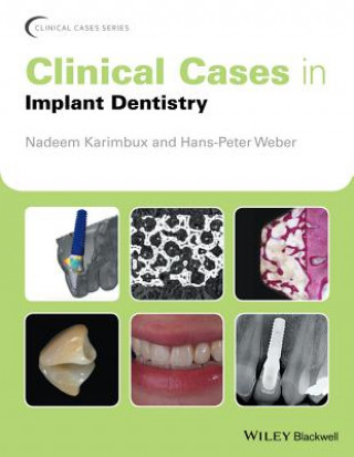 Kniha Clinical Cases in Implant Dentistry Nadeem Karimbux