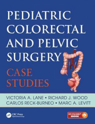 Könyv Pediatric Colorectal and Pelvic Surgery Richard J. Wood
