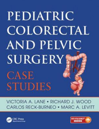 Kniha Pediatric Colorectal and Pelvic Surgery Richard J. Wood