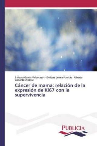 Книга Cáncer de mama: relación de la expresión de Ki67 con la supervivencia Bárbara Garcia Valdecasas