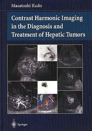 Книга Contrast Harmonic Imaging in the Diagnosis and Treatment of Hepatic Tumors Masatoshi Kudo