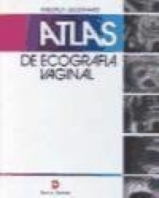 Carte Atlas de ecografía vaginal Friedrich Degenhardt