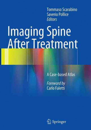 Книга Imaging Spine After Treatment Tommaso Scarabino