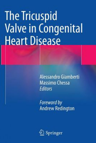 Kniha Tricuspid Valve in Congenital Heart Disease Massimo Chessa