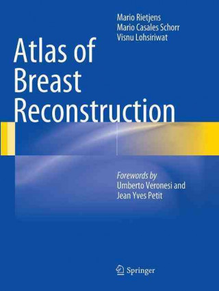 Knjiga Atlas of Breast Reconstruction Mario Rietjens